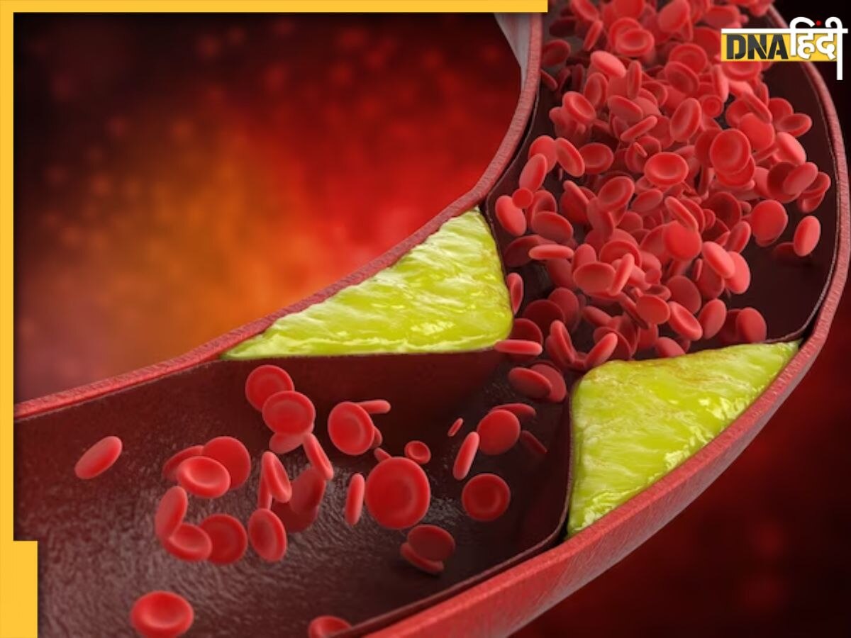 Cholesterol Remedy: शरीर में जमा गंदा कॉलेस्ट्रोल सोख लेते हैं ये 5 फूड्स, डाइट में जरूर करें शामिल