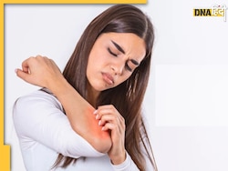 Skin Itching Remedies: सर्दियों में हाथ-पैरों की खुजली और स्किन रेडनेस से हैं परेशान, इन 4 घरेलू उपायों से मिलेगा आरा��म