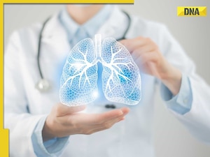 Bacterial or viral pneumonia? Here's how to spot the difference