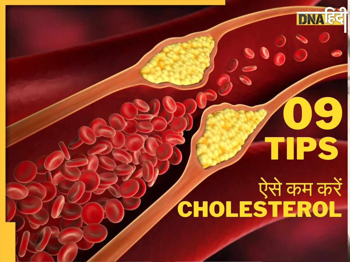 High Cholesterol को कंट्रोल करें महज 5 दिन में, आयुर्वेदिक डॉक्टर ने बताए 10 नुस्खे