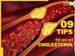 High Cholesterol को कंट्रोल करें महज 5 दिन में, आयुर्वेदिक �डॉक्टर ने बताए 10 नुस्खे
