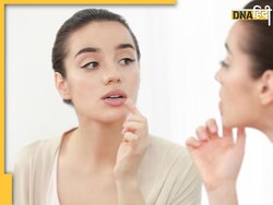 Lips Care Tips: अच्छे होंठों के लिए आजमाएं ये 5 टिप्स, सर्दियों में सूखे और फटे होंठों से मिलेगा छुटकारा