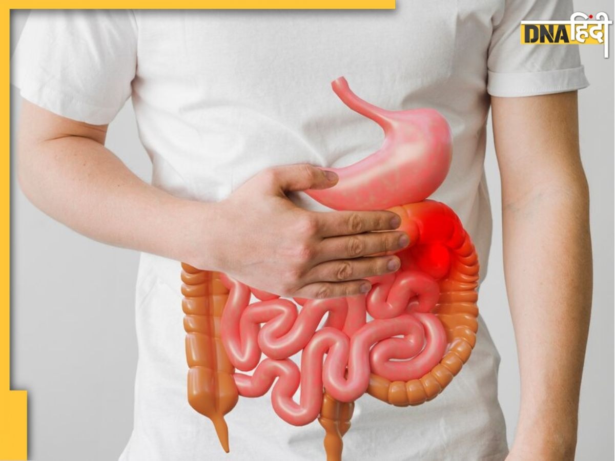 Gut Health Improvement: ठंड में गट हेल्थ बनाए रखना है बेहतर तो अपनाएं ये 5 टिप्स, पेट से जुड़ी हर समस्या होगी दूर