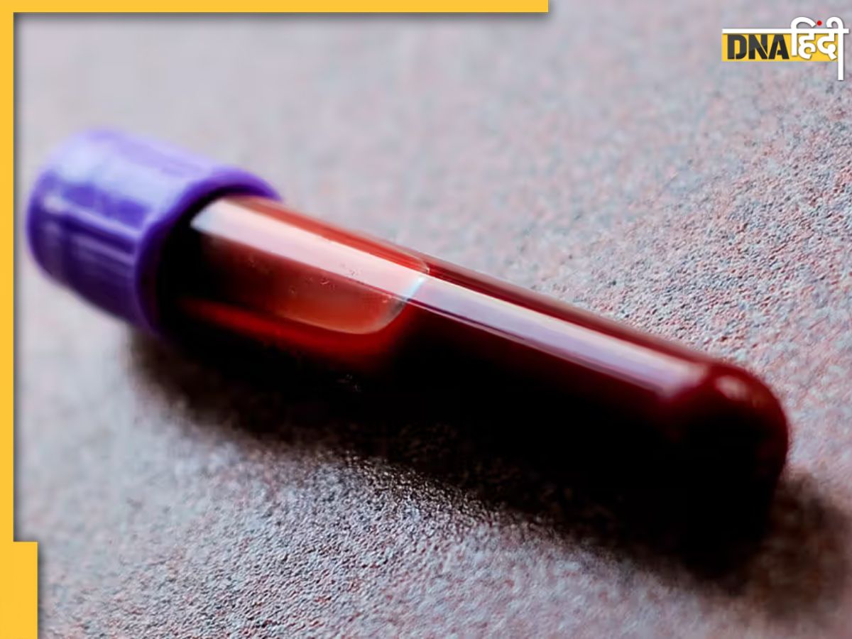 Thick Blood Reason ठंड के मौसम में क्यों गाढ़ा होने लगता है खून, जानिए