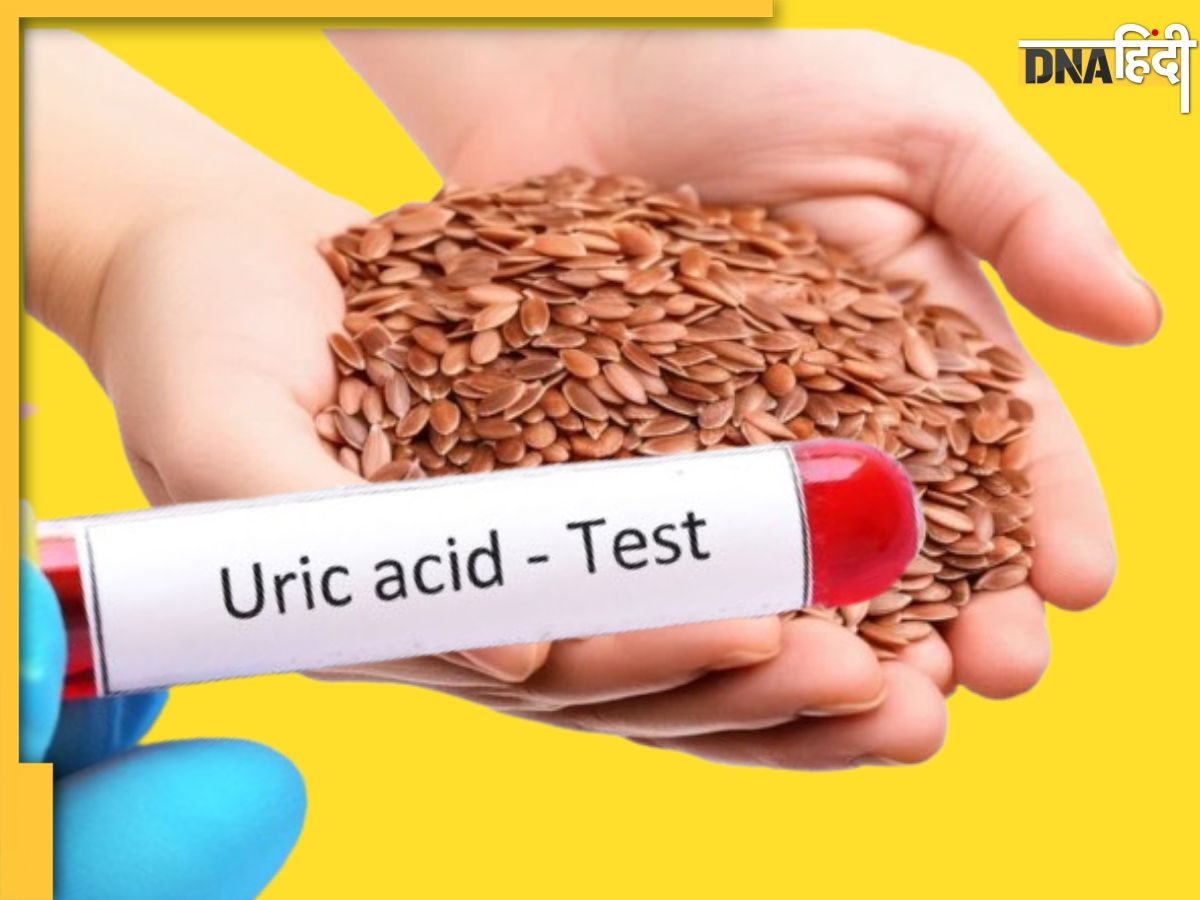 Control Uric Acid: यूरिक एसिड को देनी हो पटकनिया, तो झटपट बनाएं ये 5 चटनियां और कर जाएं चट