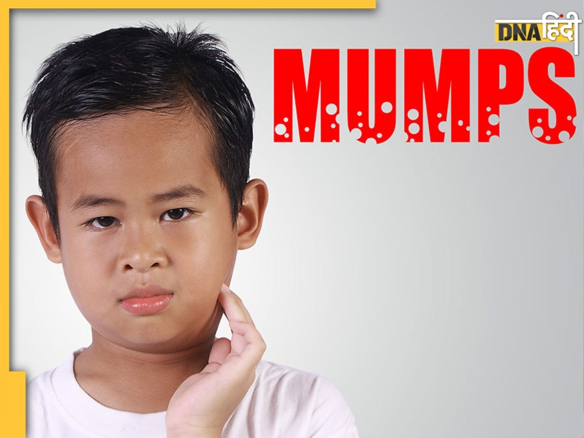 Mumps Virus Attack: तेजी से फैल रहा बच्चों में मम्प्स वायरस, जान लें लक्षण और बचाव का आसान तरीका