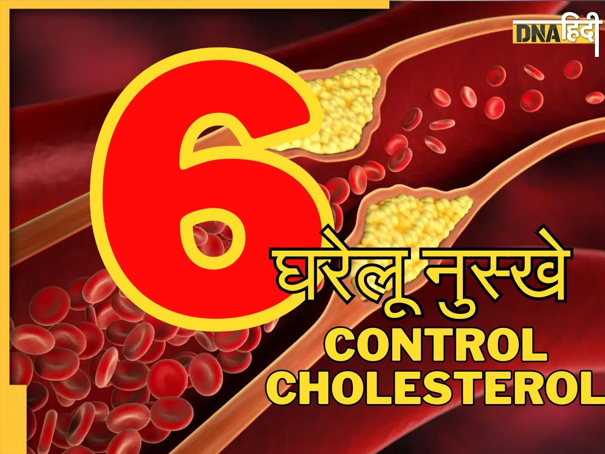 Cholesterol Control Remedy: कोलेस्ट्रॉल के छक्के छुड़ा देंगी आपकी ये 6 आदतें