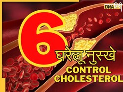 Cholesterol Control Remedy: कोलेस्ट्रॉल के छक�्के छुड़ा देंगी आपकी ये 6 आदतें