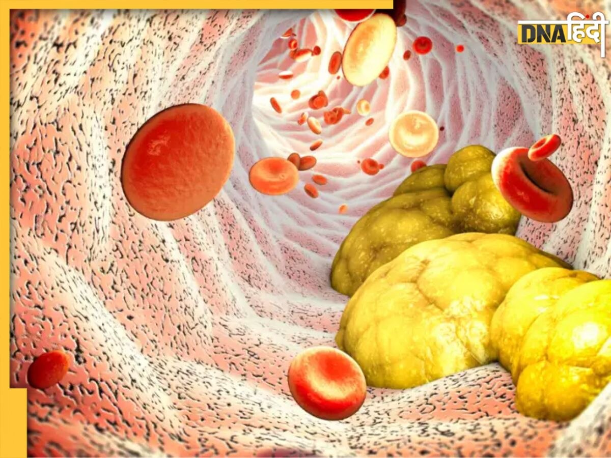 Reduce Bad Cholesterol: नसों में जमा गंदा कोलेस्ट्रॉल पानी की तरह बहा देंगी ये 5 चीजें, हमेशा हेल्द��ी रहेगा हार्ट