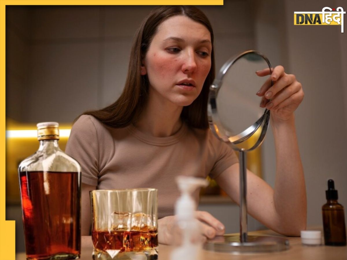 Alcohol Side Effects: लिवर, किडनी ही नहीं, स्किन से जुड़ी इन बीमारियों का खतरा बढ़ाती है शराब, जानें वजह