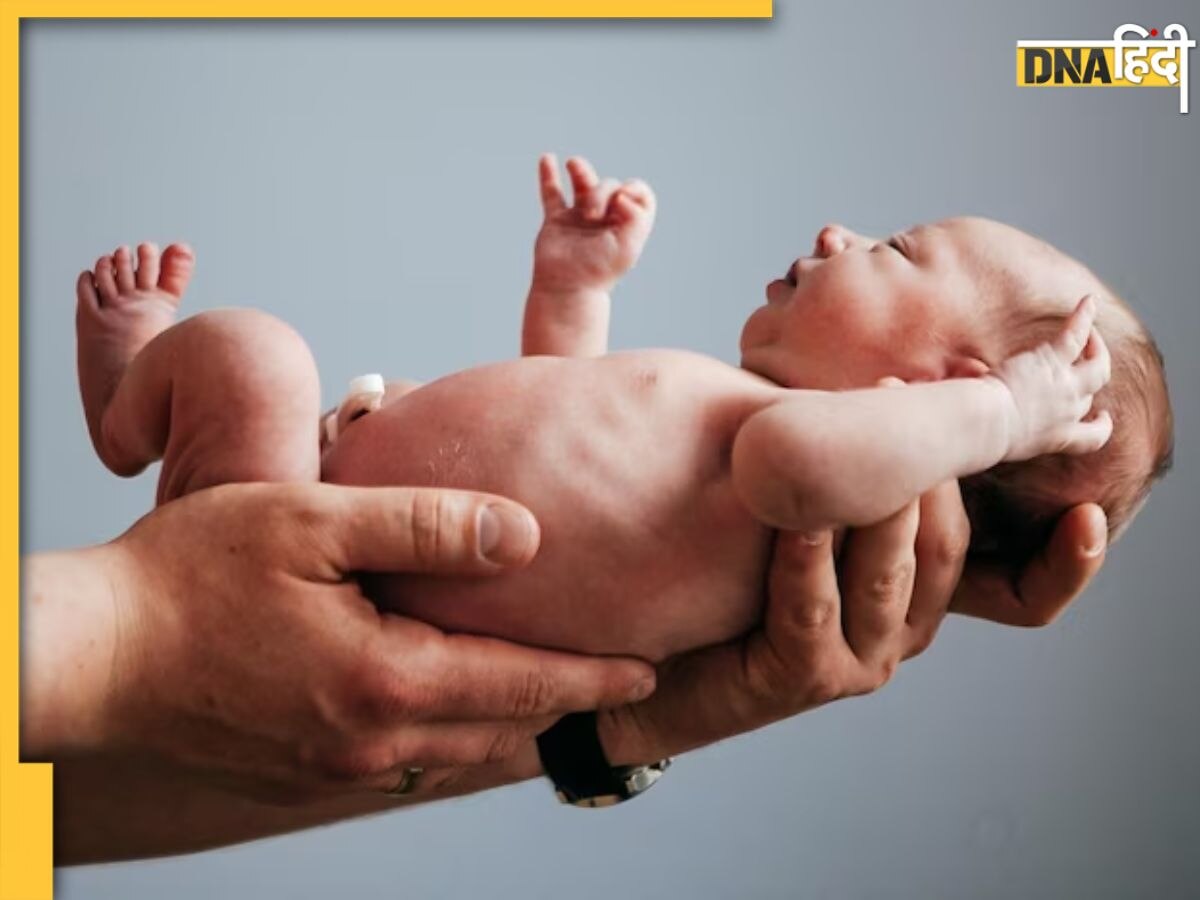 Birth Defects से बेबी को रखना है सेफ तो प्रेगनेंसी में इन बातों रखें ध्यान, बच्चे में नहीं होगा कोई जन्म दोष