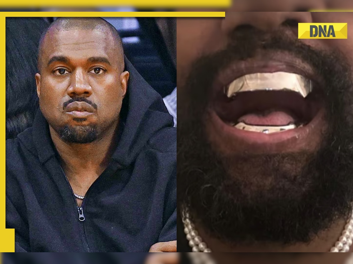 'Too much money' Kanye West replaces his teeth with Rs 7 crore