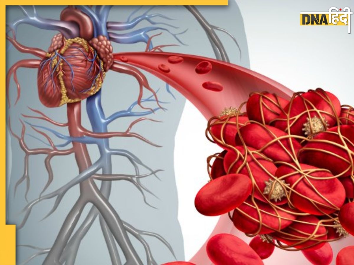 Blood Clot Risk: ठंड में नसों में क्यों जम जाते हैं खून के थक्के? जानें क्या है इसका कारण, लक्षण और बचाव के उपाय