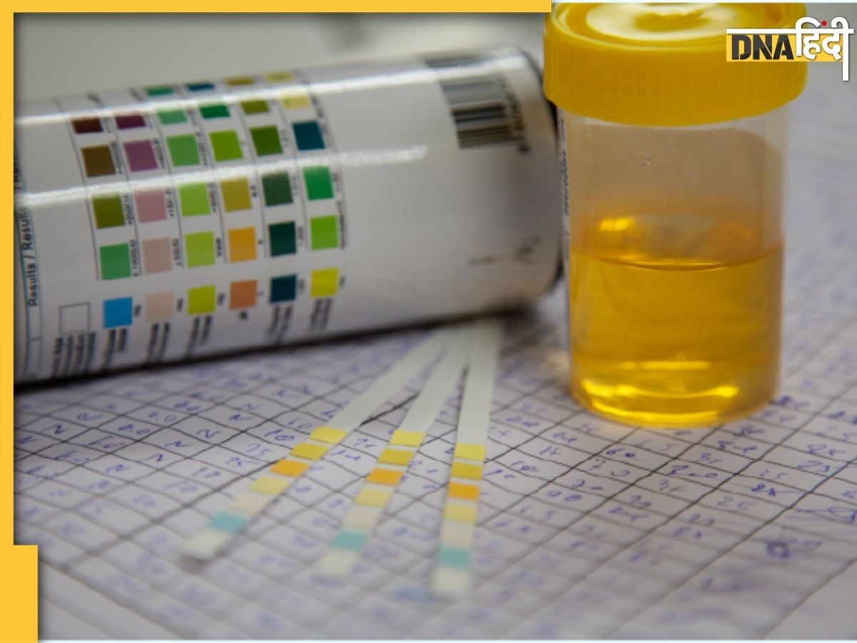 Urine Color:यूरिन के 7 कलर किडनी डिजीज से लेकर कैंसर तक का देते हैं संकेत, पेशाब के ये रंग देखते ही डॉक्टर से लें परामर्श 