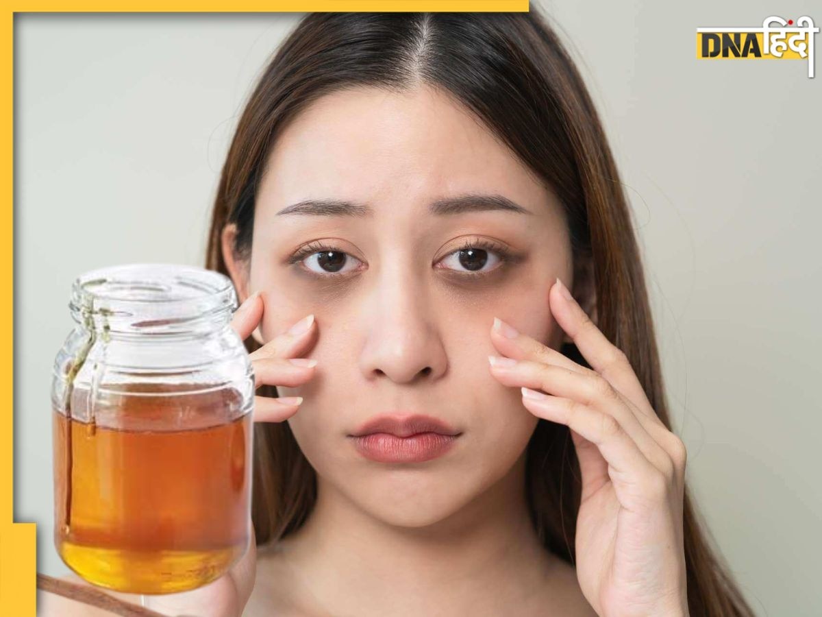 Dark Circles को दूर कर सकता है शहद का इस्तेमाल, इस तरह यूज करने से मिलेगा फायदा