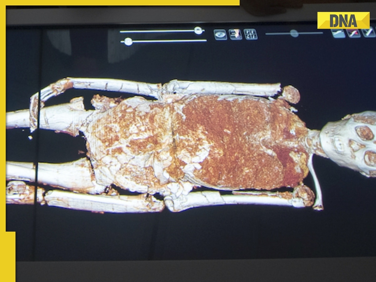 How sudden deaths are being investigated through virtual autopsy