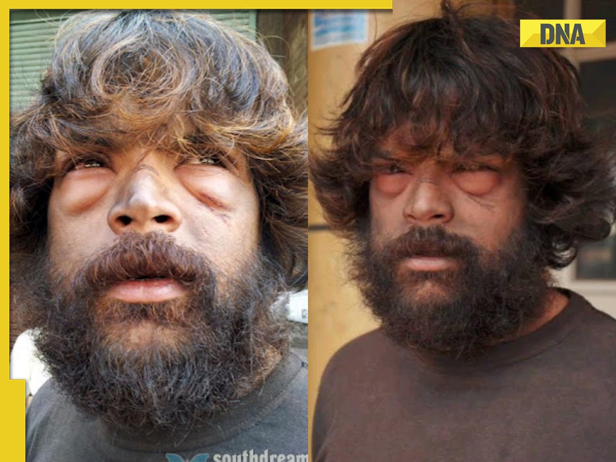 Meet actor who didn't sleep and eat for 12 nights, lost 17 kg, risked ...