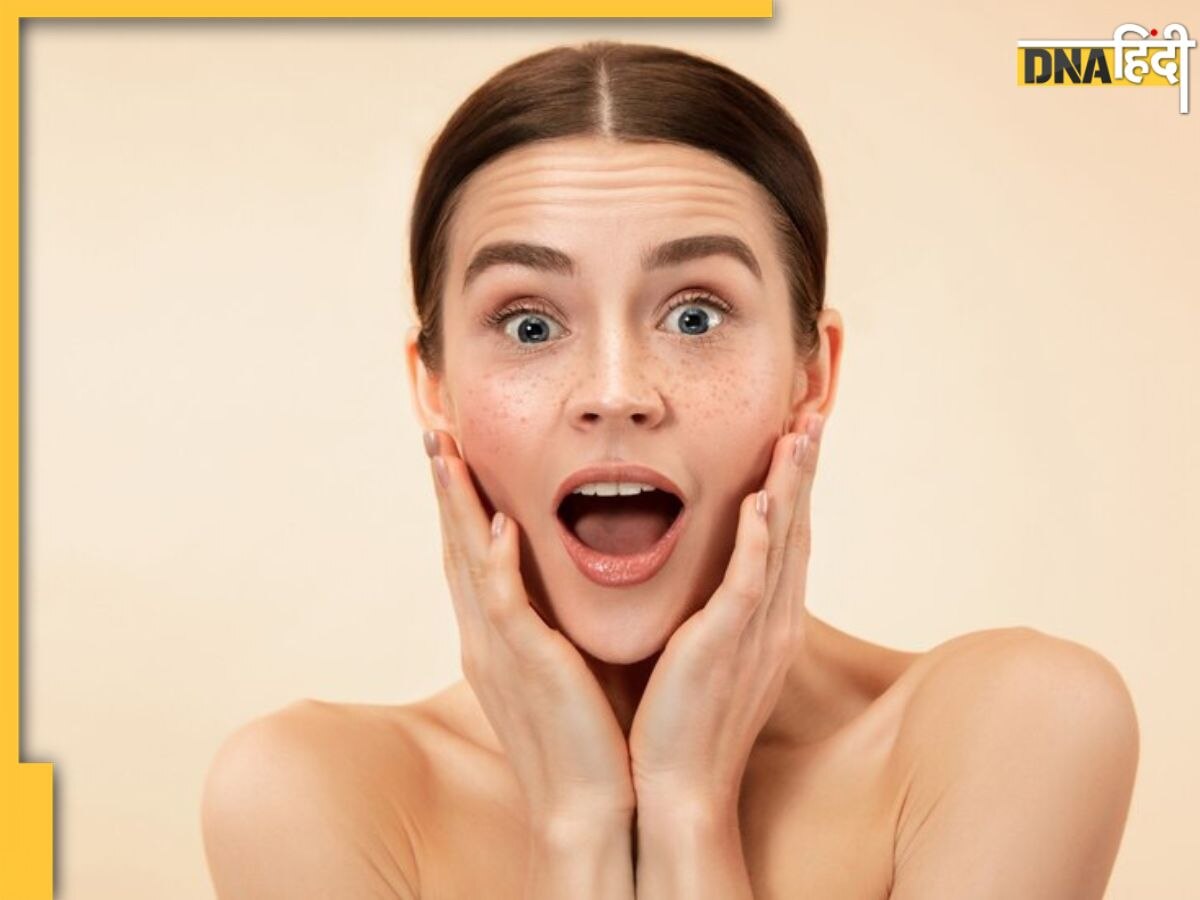 Blackheads की समस्या को दूर करने के लिए चेहरे पर लगाएं ये Homemade Face Mask, साफ-सुथरा दिखेगा चेहरा