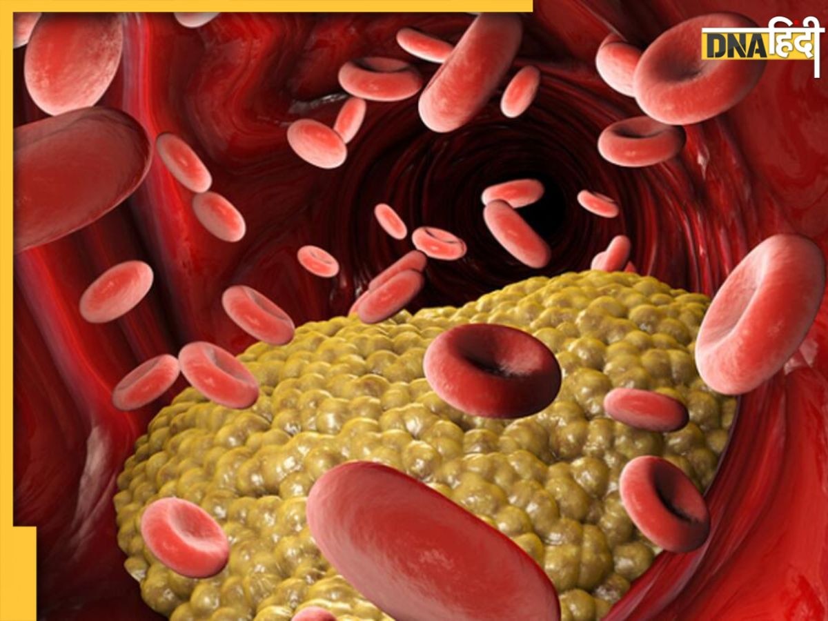 Cholesterol Control: ब्लड में जमी वसा की परतों को खुरचकर निकाल देंगी ये 6 चीजें, नेचुरली कंट्रोल होगा कोलेस्ट्रॉल