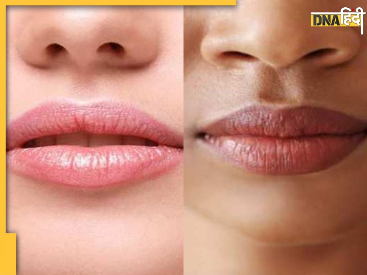 होठों का रंग पड़ गया है काला तो इन तरीकों से पाएं Natural Pink Lips, गुलाबी और चमकदार बनेंगे होंठ