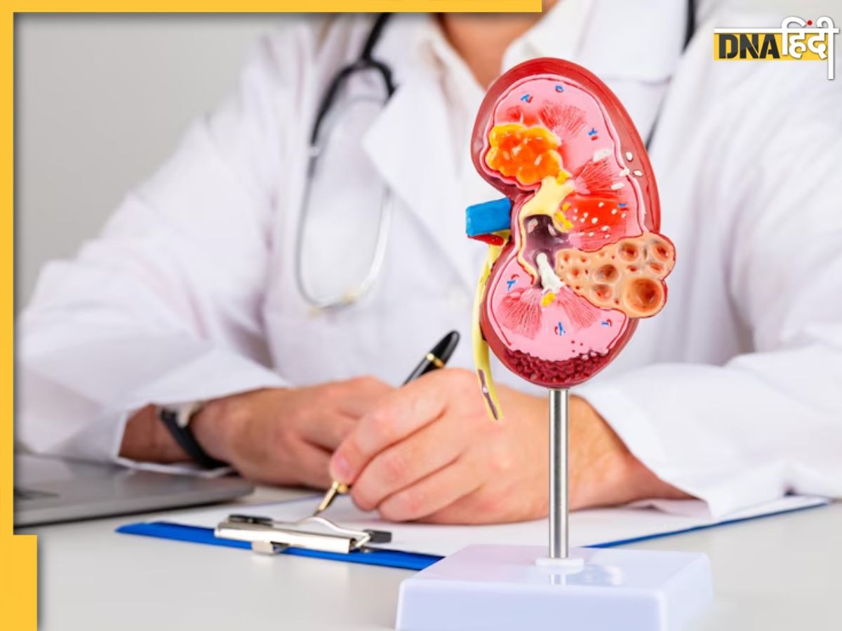 World Kidney Day: शरीर के इन अंगों पर सूजन किडनी रोग का है संकेत, भूलकर भी न करें नजरअंदाज