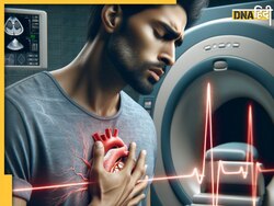British वैज्ञानिकों का दावा, AI टूल बताएगा आपमें हृदय रोगों से मौत का खतरा है या नहीं