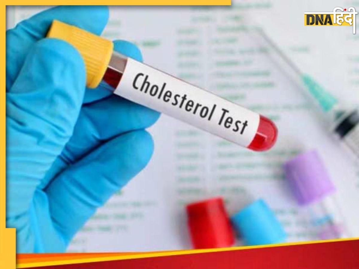 Cholesterol Test कराने से पहले भूलकर भी न करें ये काम, वरना सही नहीं आएगा रिजल्ट