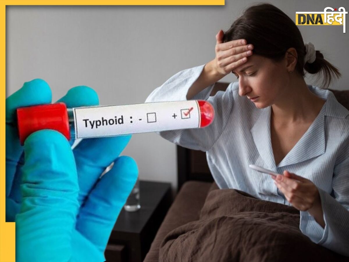 Typhoid Fever में दवा के साथ एक्स्ट्रा केयर भी है जरूरी, इन घरेलू उपायों से मिलेगी राहत