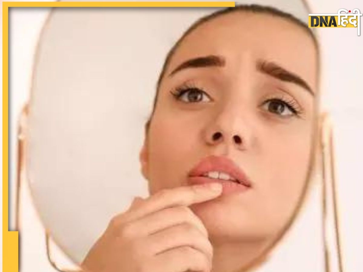 Swelling on Lips: मुंह और होठों में सूजन, मसूड़े में घाव या गले में कुछ फंसने जैसा महसूस होना जानलेवा भी हो सकता है