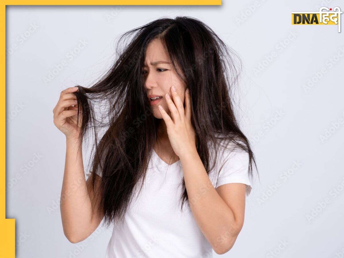 What Causes Fatigue-Hair fall: बालों का अत्यधिक झड़ना और थकान होना इस पोषक तत्व की भयंकर कमी का है संकेत