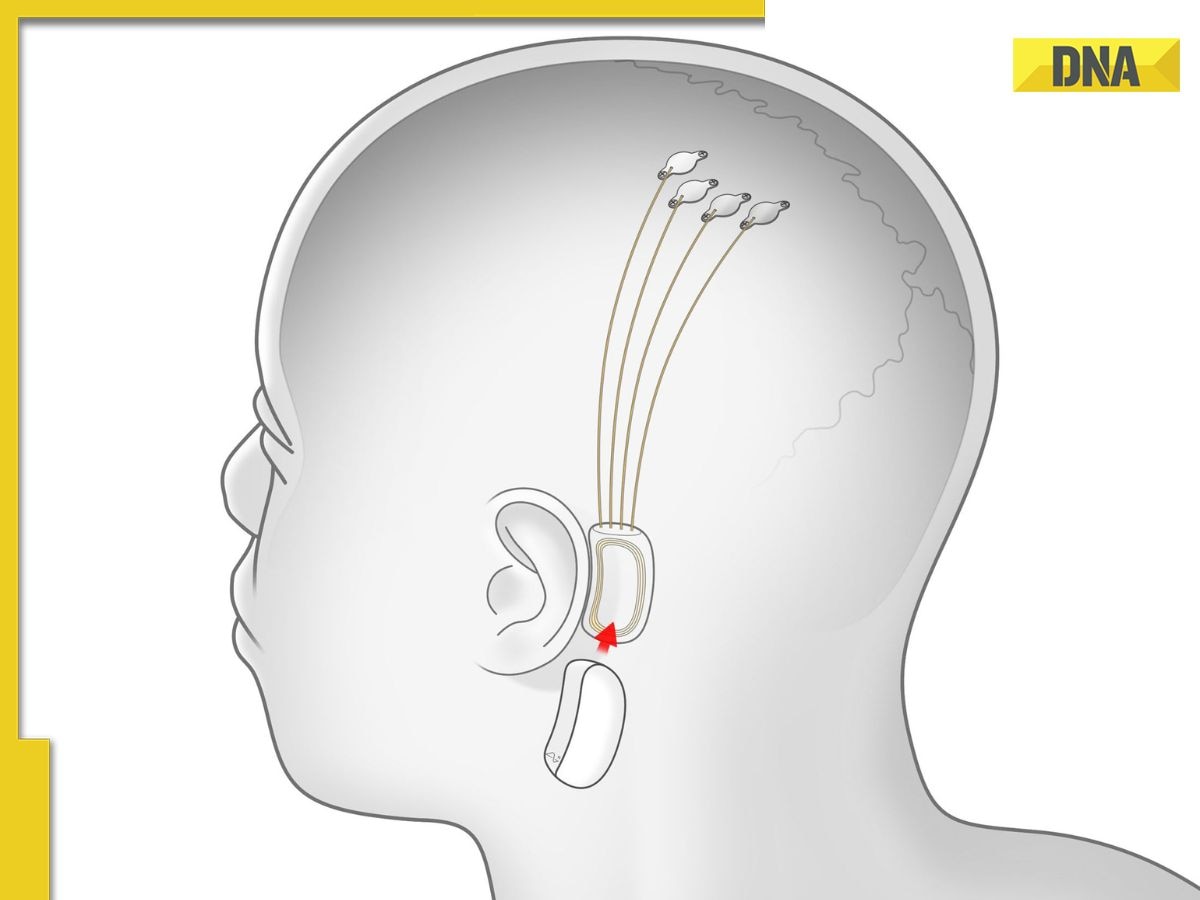Elon Musk backed Neuralink hits big milestone, implanted brain chip completes 100 days