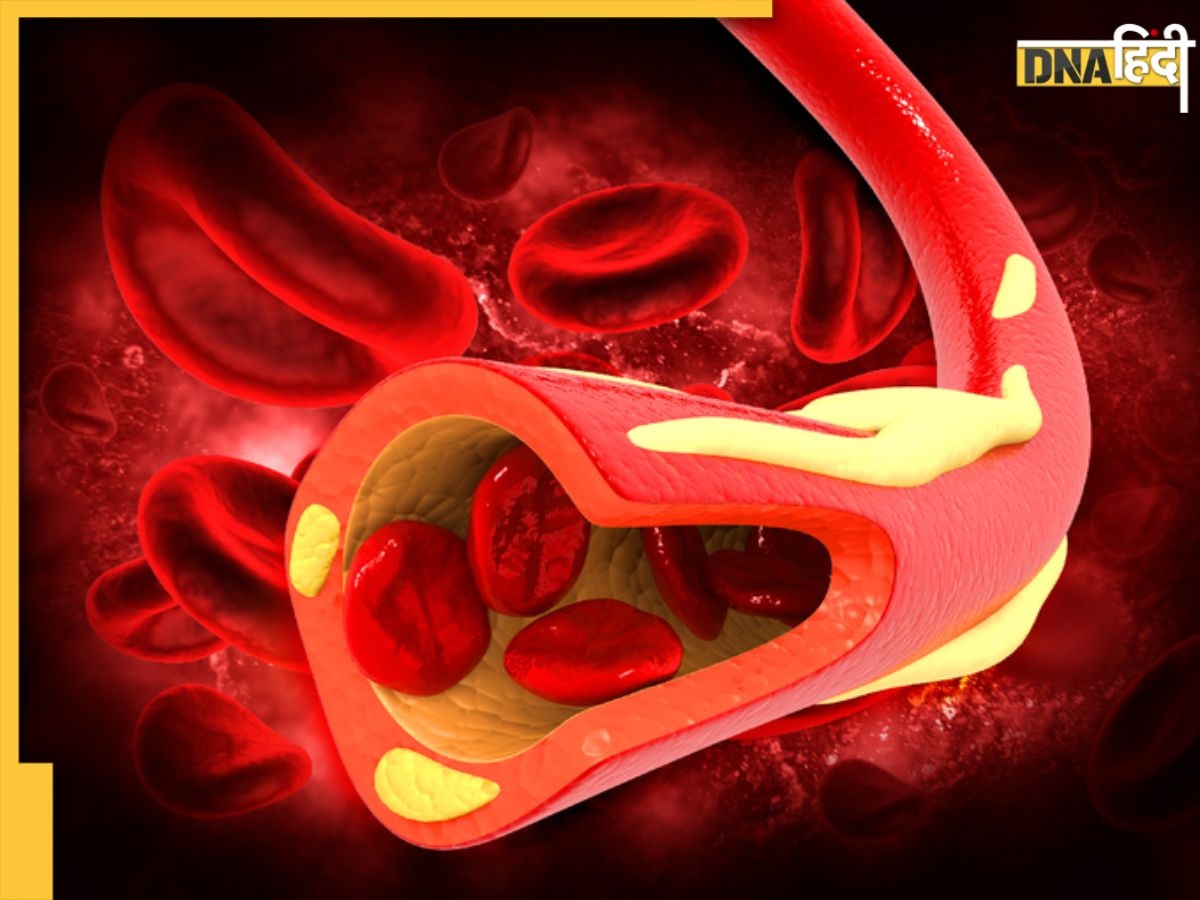 बंद नसे होंगी साफ, Bad Cholesterol कम करने के लिए खाली पेट खाएं ये 5 चीजें