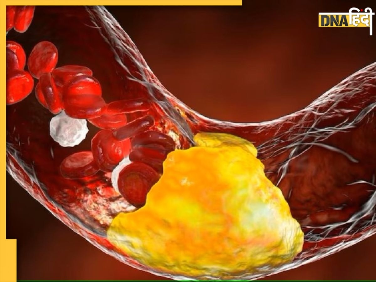 Cholesterol Remedy: धमनियों में जमा गंदा कोलेस्ट्रॉल पानी की तरह बह जाएगा, बस रोज सुबह-शाम खा लें ये काले बीज