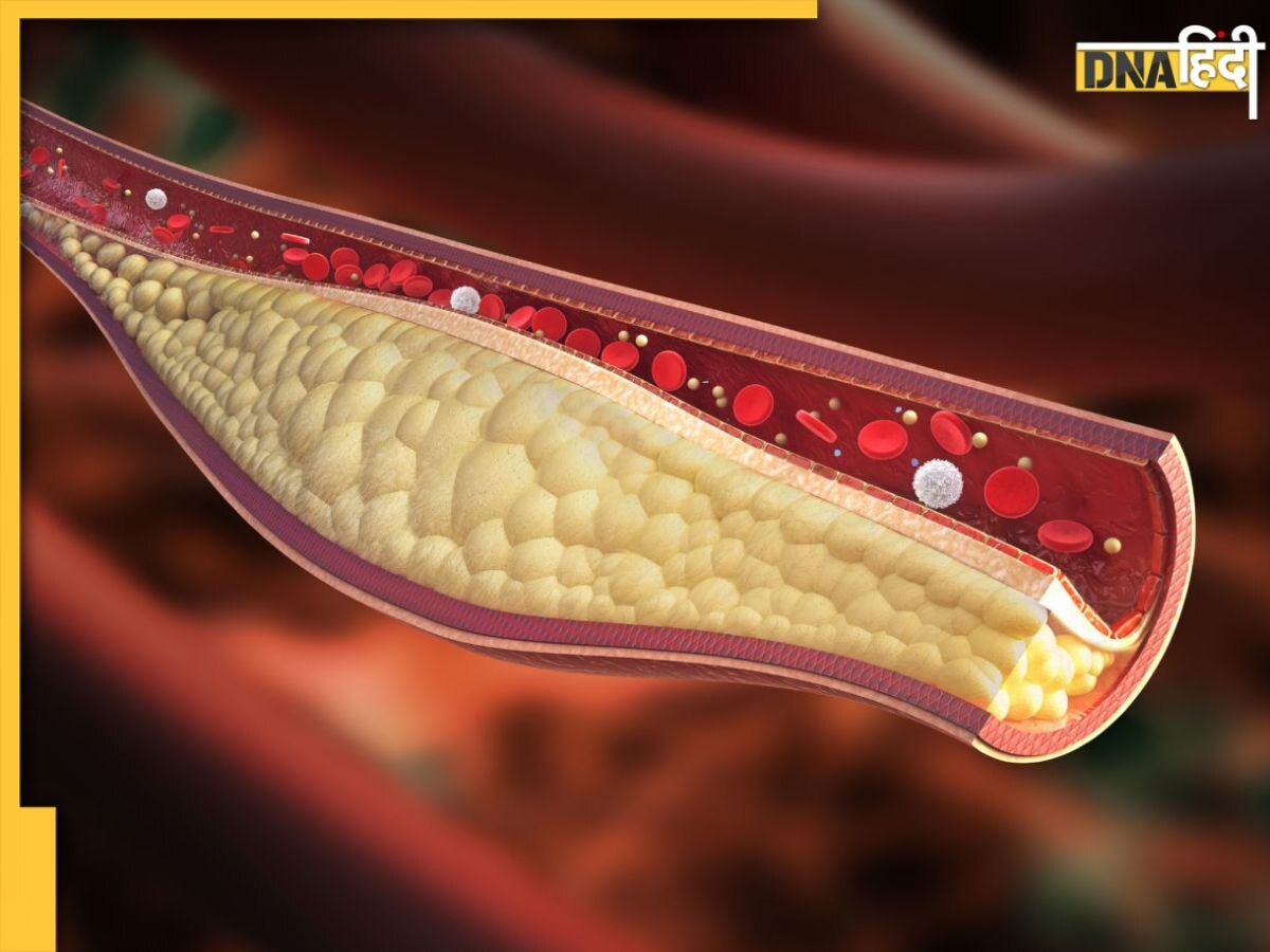 Good Cholesterol Remedy: गुड कोलेस्ट्रॉल बढ़ाती हैं ये सब्जियां, नसों में फंसा गंदा पीला फैट निकल जाएगा