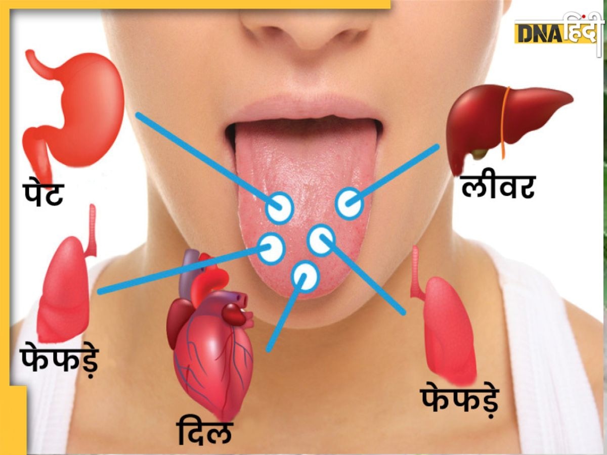 Tongue color Sign: जीभ का रंग खोल देगा सेहत की पोल, लिवर की खरा�बी से लेकर विटामिन की कमी तक पर दिखते हैं ये संकेत