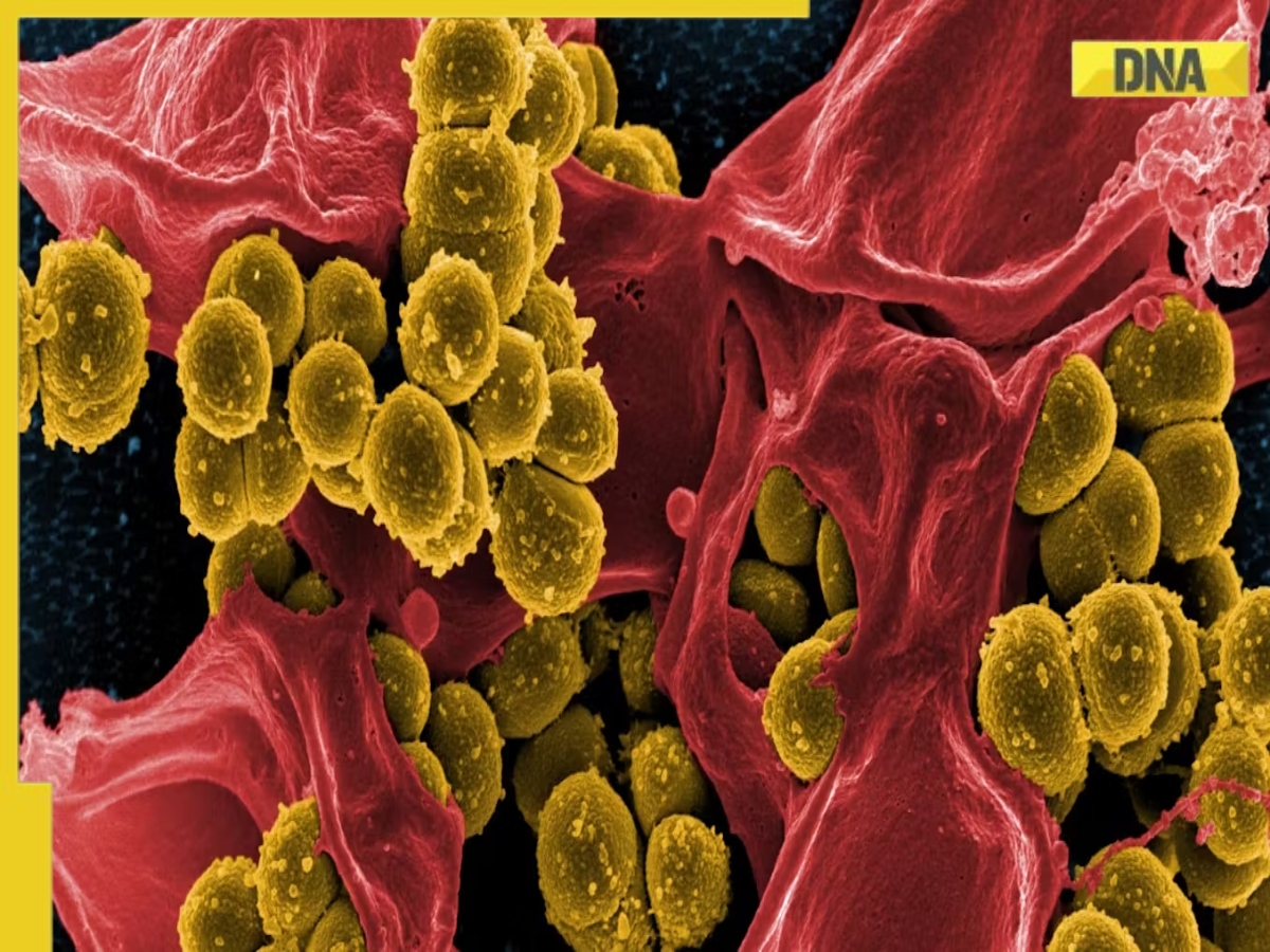 Beautiful Deadly 'superbug' Is Spreading Across Us As Drug Resistance Grows, Researchers Warn Background Nature Beautiful Deadly 'superbug' Is Spreading Across Us As Drug Resistance Grows, Researchers Warn Background Nature
