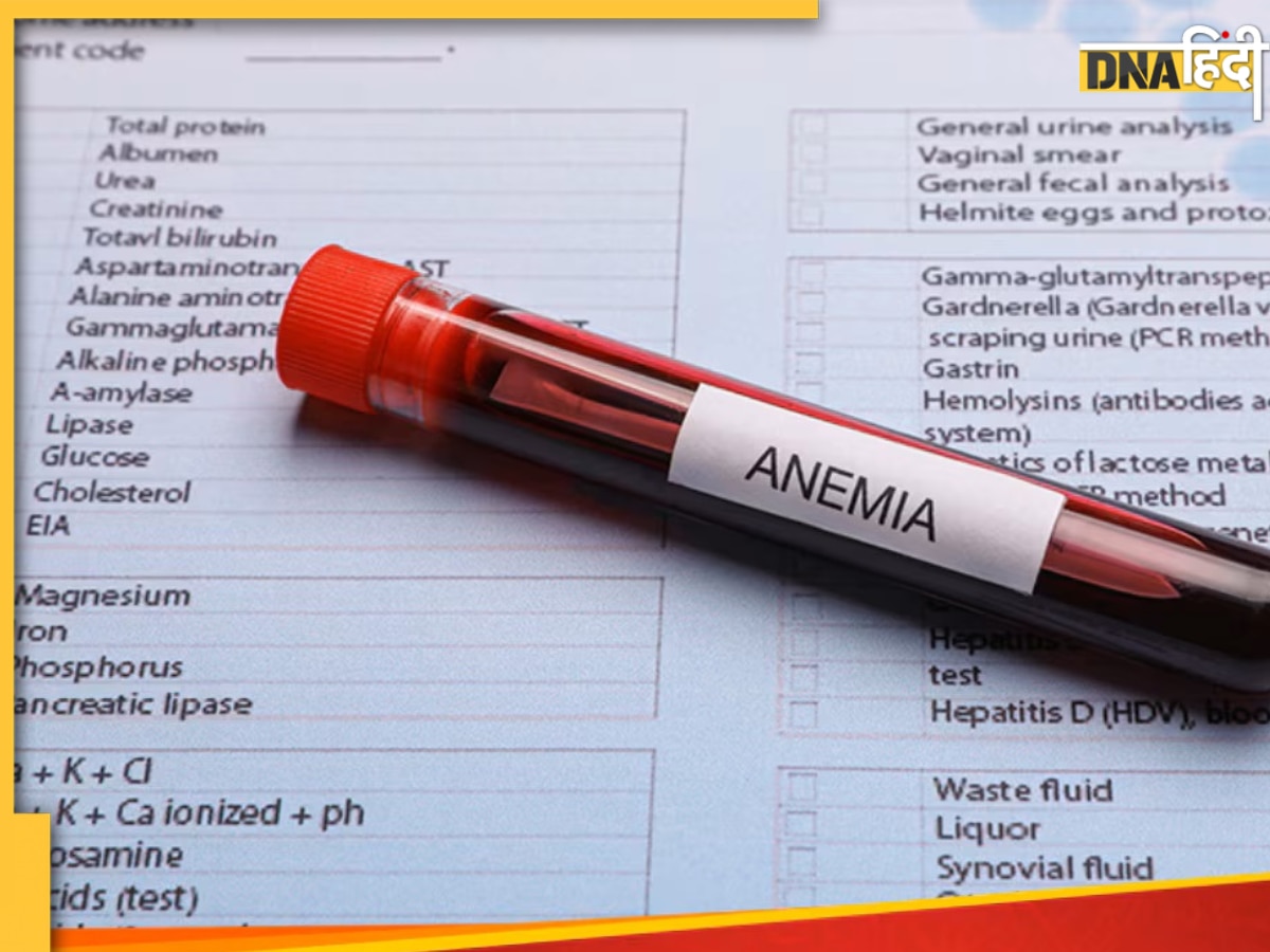 Hemoglobin Check at Home: घर पर ही चेक किया जा सकता है हीमोग्लोबिन लेवल, एक क्लिक पर स्मार्टफोन देगा रिपोर्ट