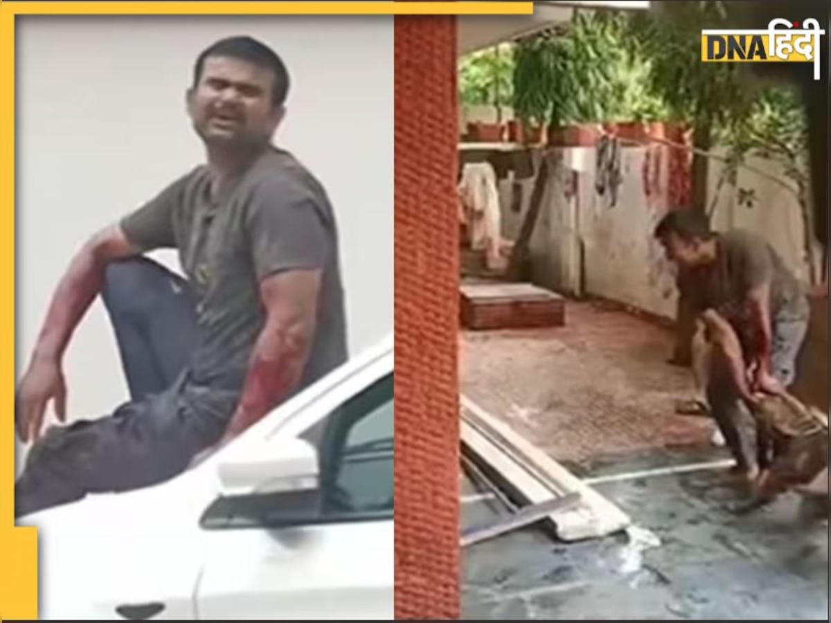 घर सामान देने आए Delivery Agent को नोचता रहा Pitbull, कोई न�हीं आया मदद को बाहर,Video हुआ वायरल 