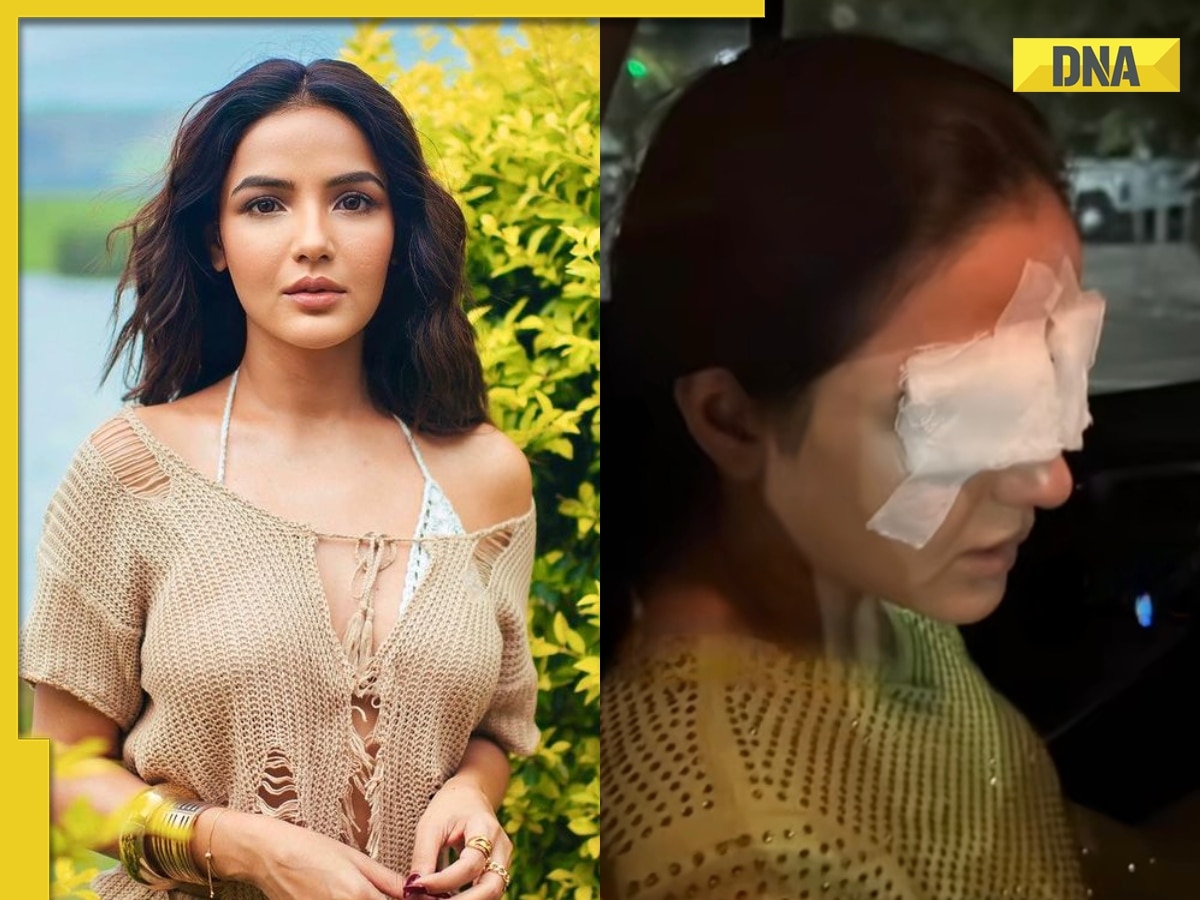 'I can't see': Jasmin Bhasin says she damaged her corneas after wearing lenses, undergoes treatment