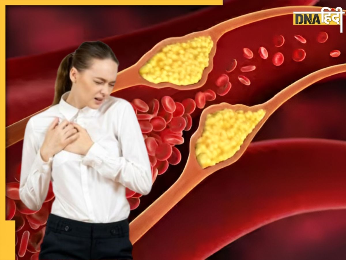 नसों में जमा Bad Cholesterol बाहर निकाल फेकेंगे ये 4 हरे फल, दुरुस्त रहेगा दिल का हाल