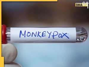 कोरोना के बाद अब डराने लगा Mpox वायरस, WHO ने बुलाई इमरजेंसी मीटिंग