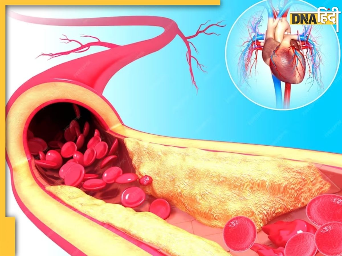 नसों में जमा Bad Cholesterol को बाहर कर देंगी रोजमर्रा की ये 5 आदतें, हेल्दी रहेगा हार्ट