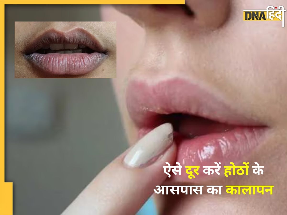 Lip Care Tips: काली पड़ गई है होठों के आसपास की स्किन? जान लें इसके कारण और दूर करने के उपाय