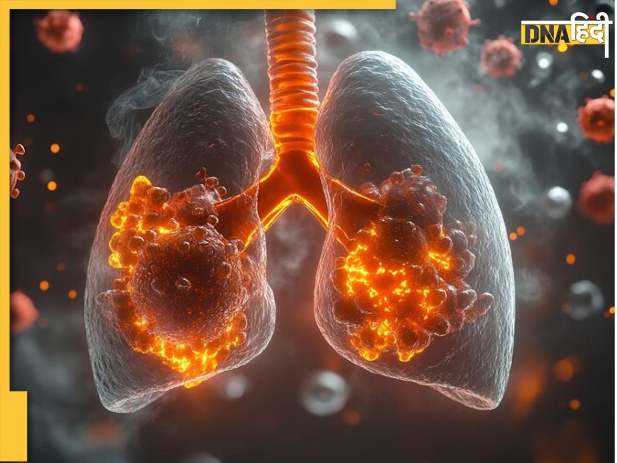 हड्डियों से लेकर सीने तक में महसूस हो सकते हैं Lung Cancer के ये लक्षण, न करें इग्नोर