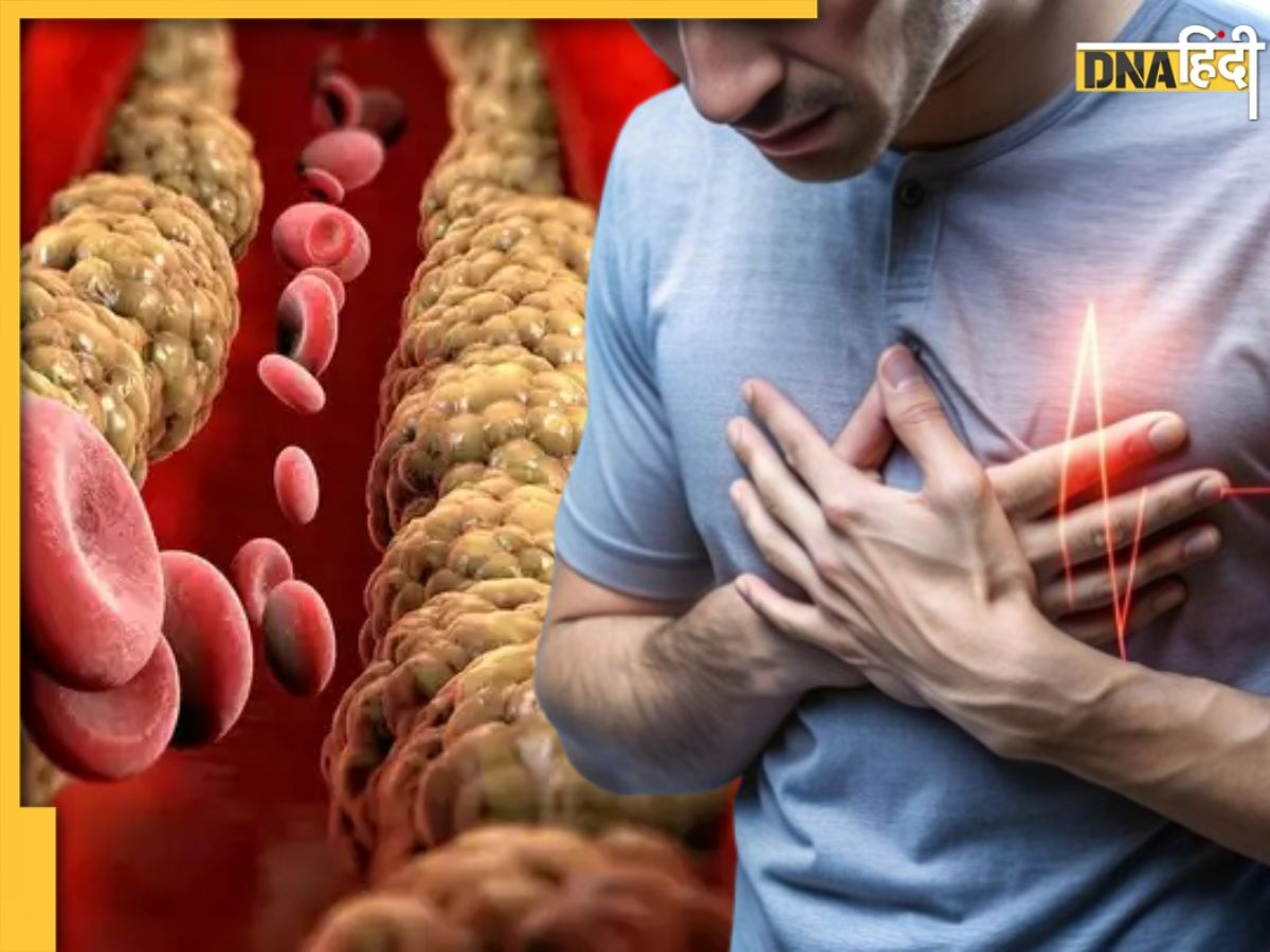 नसों में चिपके Bad Cholesterol को खत्म कर देंगे ये 5 घरेलू नुस्खे, दुरुस्त रहेगी सेहत