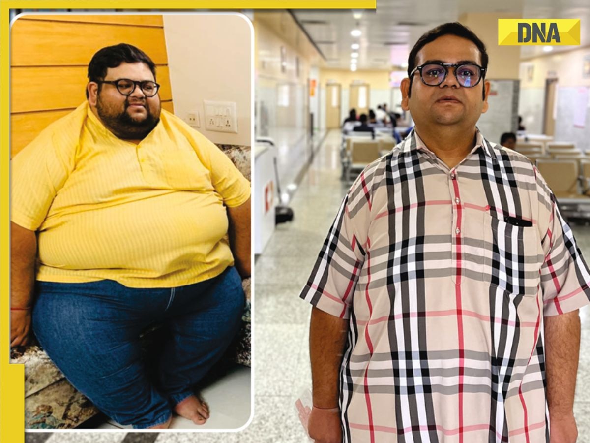 NOBESITY Surgery Helps Ahmedabad Resident Lose 109 Kg, Transforming Health and Life