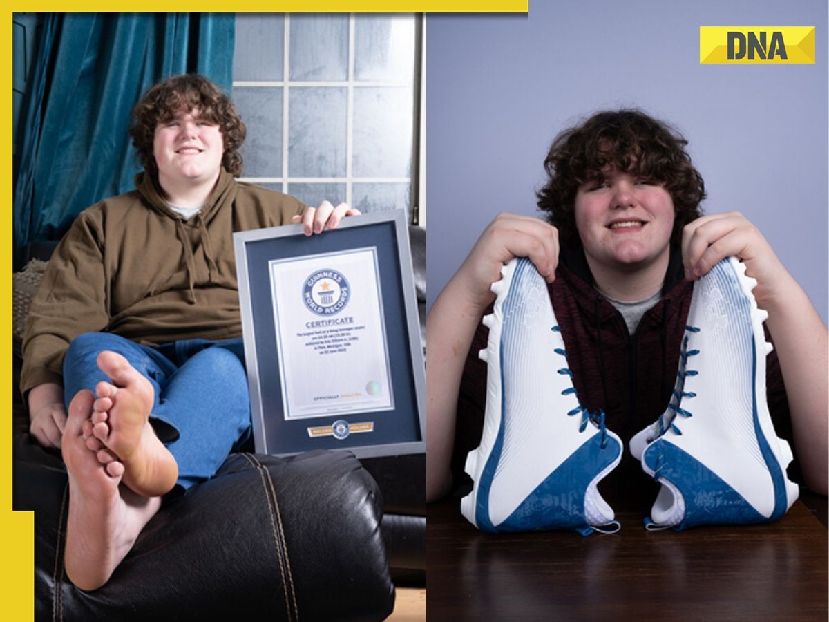 Meet teen who set Guinness World Record for largest hands, feet; they measure over…