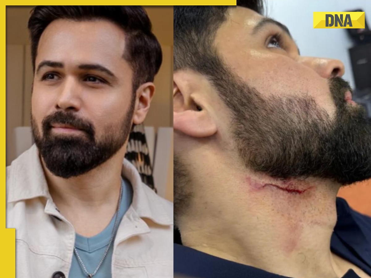 Emraan Hashmi injured on the sets of Goodachari 2 in Hyderabad, worried fans say 'get well soon'