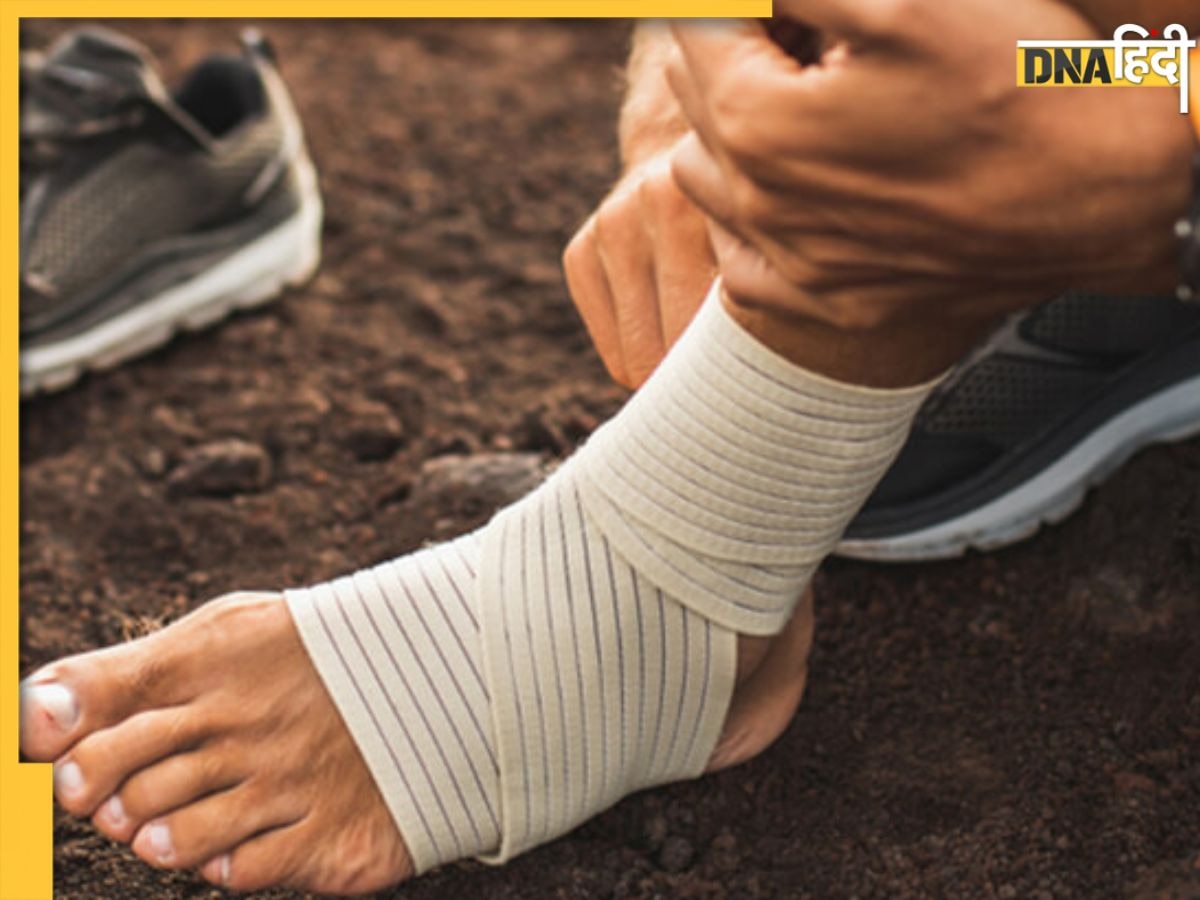 Sprain Treatment: दवा से भी ठीक नहीं हो रहा पैर की मोच का दर्द, तो ये घरेलू नुस्खों से झट से मिलेगा आराम