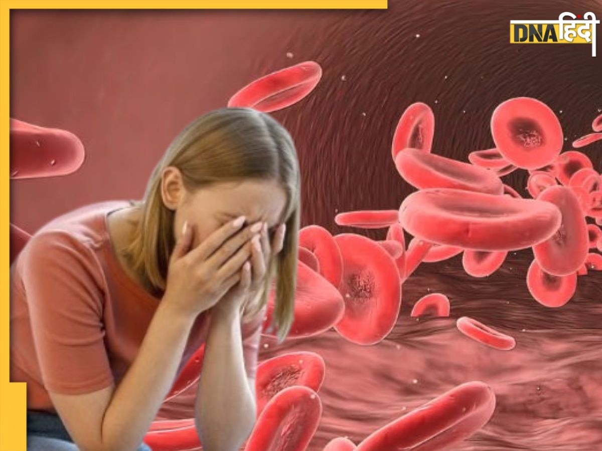 Blood Deficiency: शरीर में खून की कमी होने पर नजर आते हैं कई लक्षण, जानें कैसे दूर करें ये समस्या